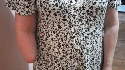 «Қолы жұлынып қалған»: «Рахат» кондитерлік фабрикасы қызметкеріне қомақты өтемақы төлейтін болды