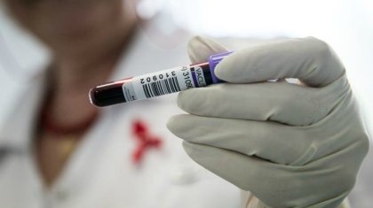 Алматыдағы орталық ауруханаға түскен 5 науқас ем алу кезінде ВИЧ жұқтырған