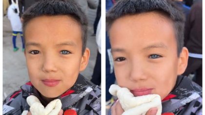 Желі қолданушылары жаратылысы ерекше балаға сүйсінді (ВИДЕО)