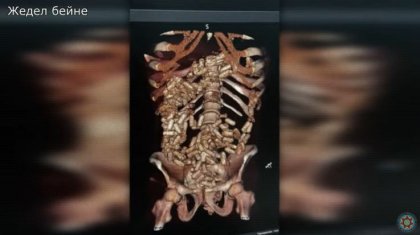 Асқазанына 2 келі апиын жасырған: ҰҚК есірткі тасымалдаған шетелдіктерді ұстады