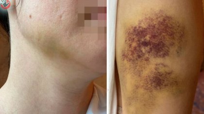 Ақсу кәсіпорнының директоры әйелін көкала қойдай етіп сабап тастаған (ФОТО)