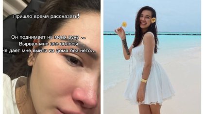 «Шашымды жұлды, қол көтереді»: Айжан Байзақова жұртты алаңдатып қойды (ВИДЕО)