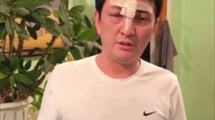 «Діншілдер «Алла жоқ!» деген сөзім үшін сабап тастады»: Академик өзіне шабуыл жасалғанын айтты (ВИДЕО)