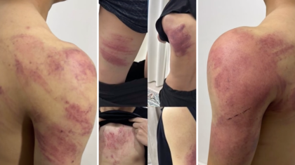 Атырауда бір топ жасөспірім 8-сынып оқушыларын аяусыз сабап тастаған (ВИДЕО)