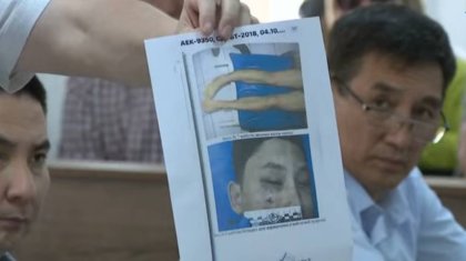 Сотта Шерзаттың денесінен анықталған жарақаттар туралы мәліметтер жарияланды