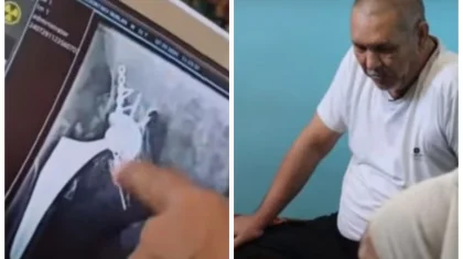 «Өтемақы ала алмай жүрміз»: Қызылордада көпбалалы әке мектепте жарақат алып, мүгедек болып  қалған