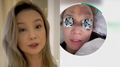 «Бас сүйек, миым мен көзім зақым алды»: Әйкерім Есенәлі көпшілікті алаңдатып қойды (ВИДЕО)