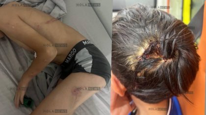 «Денесін күйдіріп, саусақтарын сындырды»: «Қазақмыс» қызметкері 8 жастағы баланы азаптаған (ФОТО)