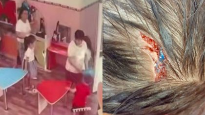 Таразда балабақша тәрбиешісі баланы пакетпен ұрып, басына жарақат салды (ВИДЕО)