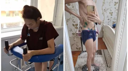 «Өлім аузынан қалдым»: Талдықорғанда дәрігерлер әйелдің жатырын рұқсатсыз алып тастаған