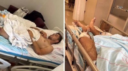 Түркияға демалуға барған қазақстандық ауыр жарақат алды