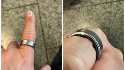 «Саусағынан айырылып қала жаздады»: Samsung смарт сақинасының кесірінен ер адам ауруханаға түсті