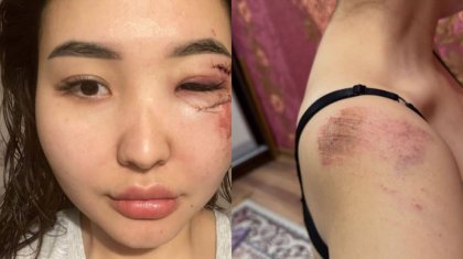 Атырауда блогерді зиратқа апарып, ұрып-соққан (ФОТО)