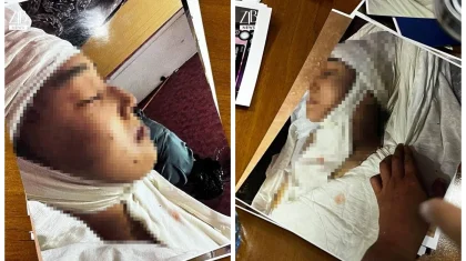 «Өлімші етіп сабаған»: Ақнәр Гүлстанның өліміне қатысты жантүршігерлік дерек шықты