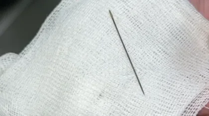 «Бауыр тұсынан енген»: Түркістанда 8 айлық баланың ішінен ине табылды