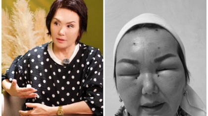 «Осымен бәрі бітті деп ойладым»: Өлім аузынан қалған блогер жан сырын ақтарды