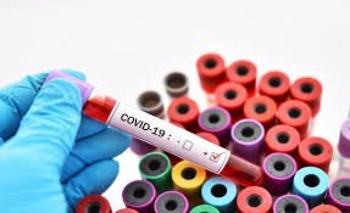 фото: coronavirus2020.kz