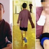 Емшіге барып қолынан айырылған маңғыстаулық баланың ата-анасы жауапқа тартылуы мүмкін